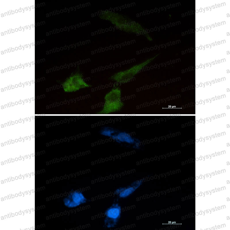 Валидация IF - AntibodySystem RHF46401