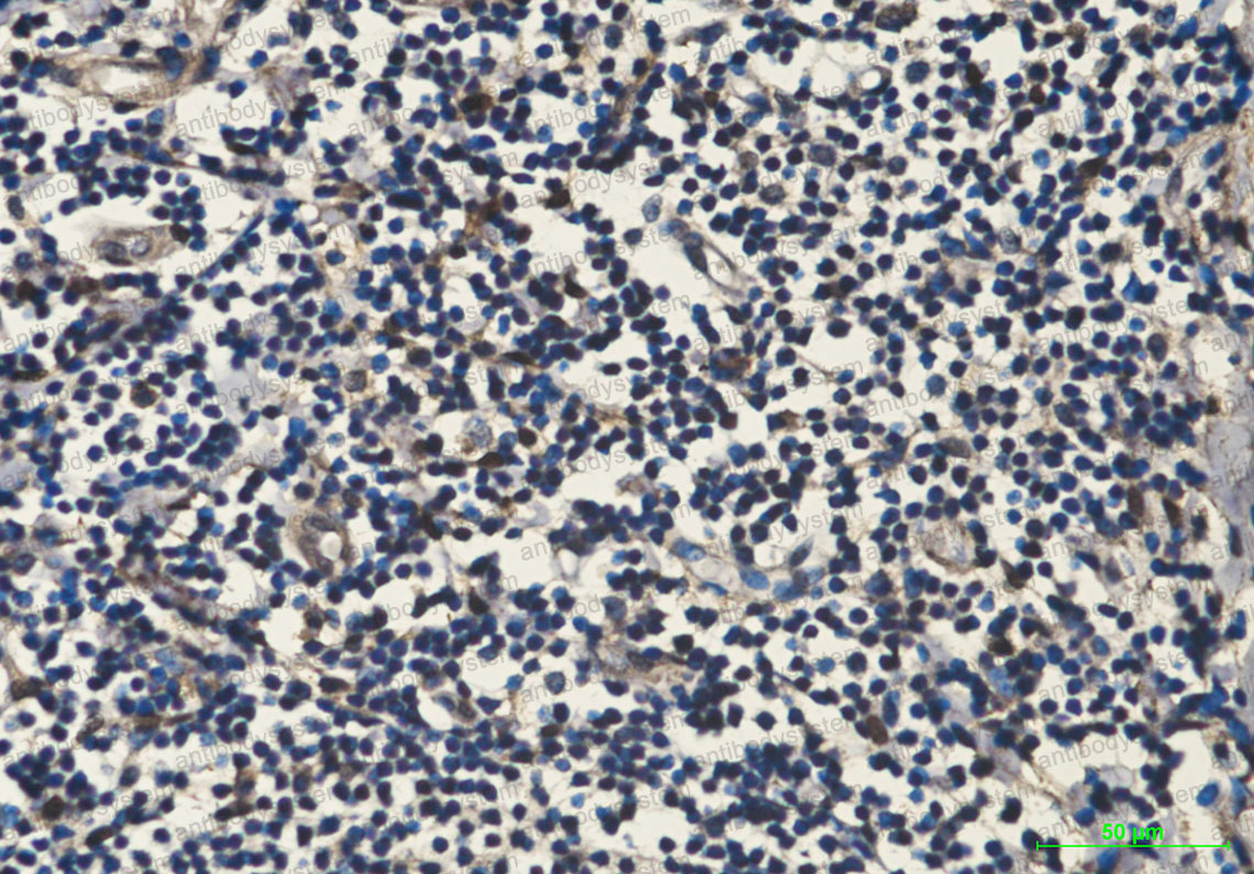 Валидация AntibodySystem RHC69305