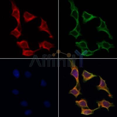 AF0385 staining Hela by IF/ICC