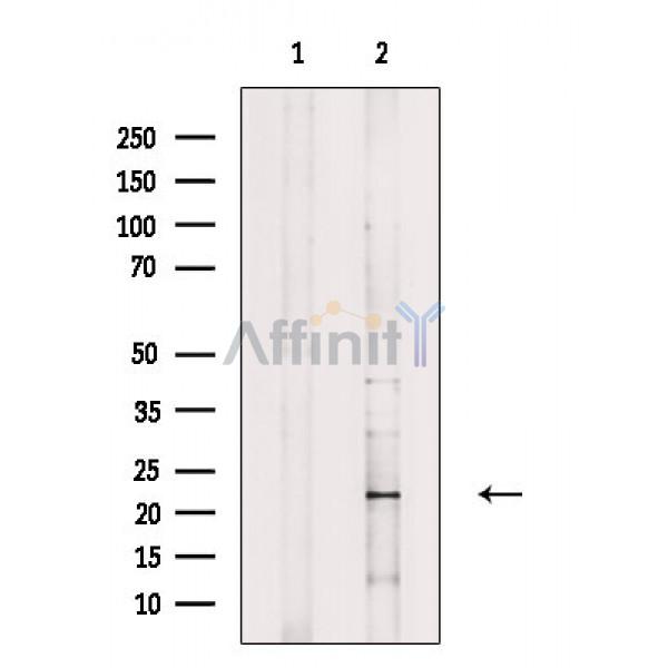 Валидация Affinity DF8971 - 21158