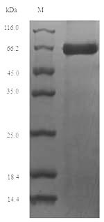 SDS-PAGE