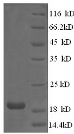 SDS-PAGE