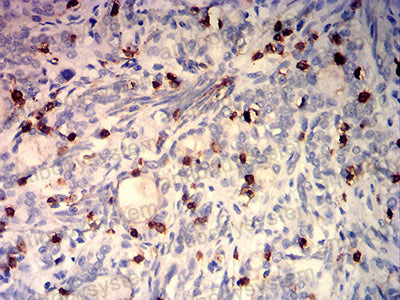 Валидация AntibodySystem RHD69203