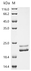 SDS-PAGE