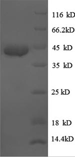 SDS-PAGE