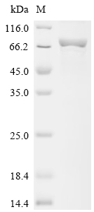 SDS-PAGE