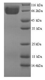 SDS-PAGE