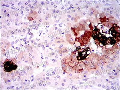 Валидация AntibodySystem RHF42104 (2504)