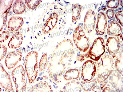 Валидация AntibodySystem RHG85602