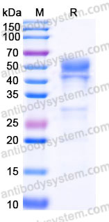 EHC08701, SDS-PAGE