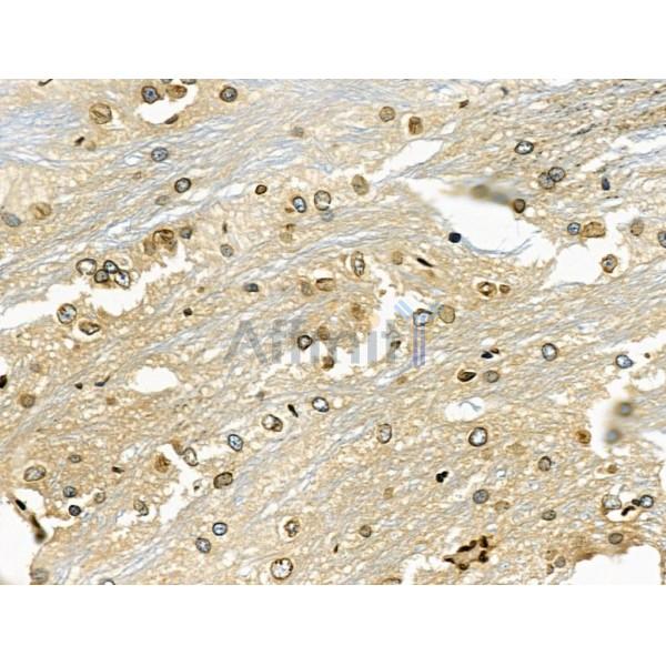 Валидация Affinity DF6173 - 17420