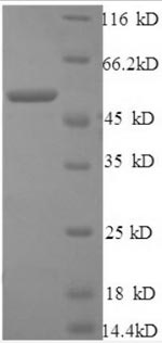SDS-PAGE