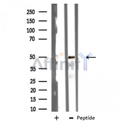 Валидация Affinity DF3314 - 14178