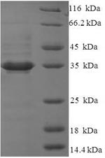 SDS-PAGE