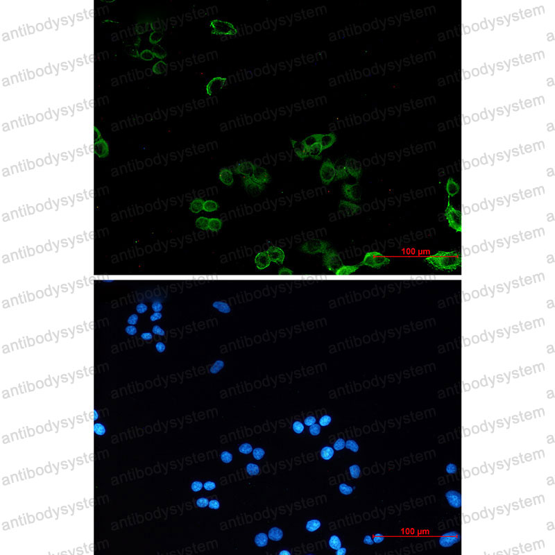 Валидация IF - AntibodySystem RHF03901