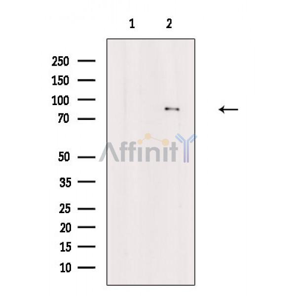 Валидация Affinity AF6861 - 4079