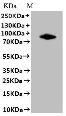 SDS-PAGE