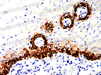 Валидация AntibodySystem RHB98003 (512)