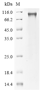 SDS-PAGE