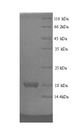 SDS-PAGE