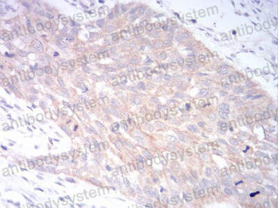 Валидация AntibodySystem RHG14203 (2868)