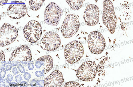 Валидация AntibodySystem RHC20005