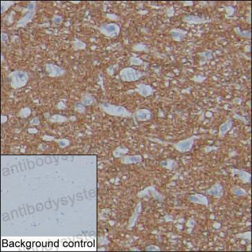 Валидация AntibodySystem RHC82447