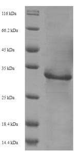 SDS-PAGE
