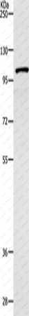 Вестерн-блоттинг, TNK2, клетки 231