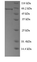 SDS-PAGE