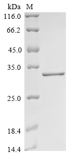 SDS-PAGE