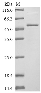 SDS-PAGE