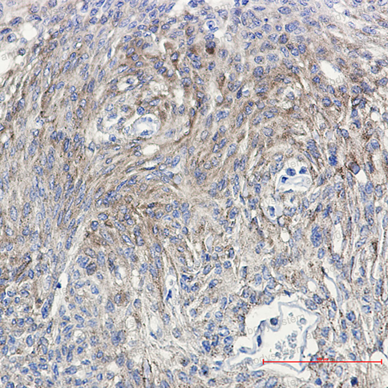 Валидация AntibodySystem RHC14005