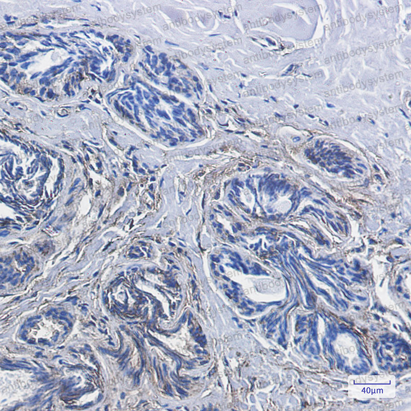 Валидация AntibodySystem RHD03604