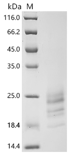 SDS-PAGE