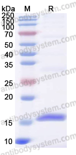 YVV40805, SDS-PAGE