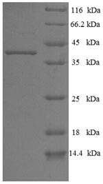 SDS-PAGE