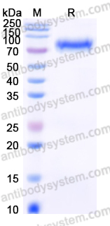 EHD47001, SDS-PAGE