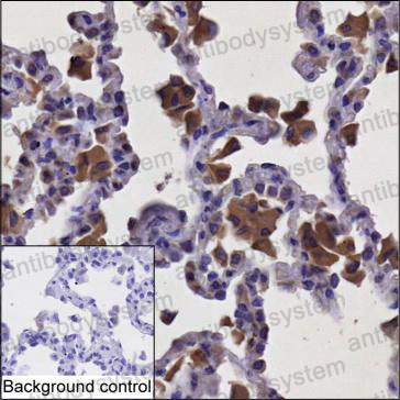 Валидация AntibodySystem RHD36202