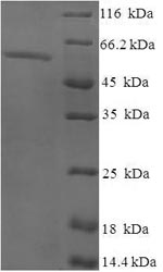 SDS-PAGE
