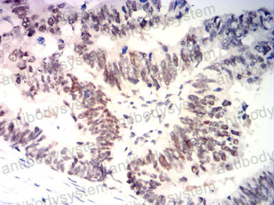 Валидация AntibodySystem RHJ35605