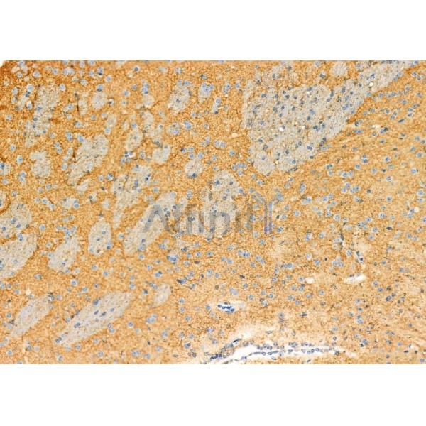 Валидация Affinity DF12333 - 6749