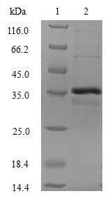 SDS-PAGE