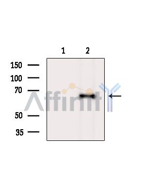 Валидация Affinity DF14196 - 10022
