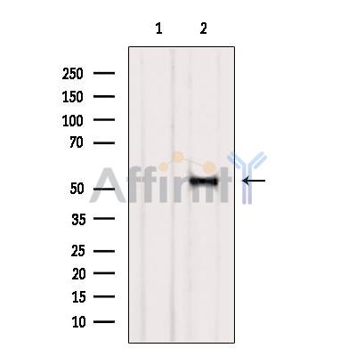 Валидация Affinity DF6349 - 17694