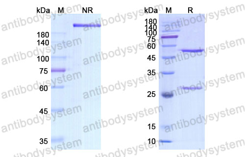 Валидация SDS-PAGE - AntibodySystem DHJ44201