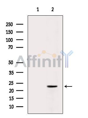 Валидация Affinity DF15295 - 11591
