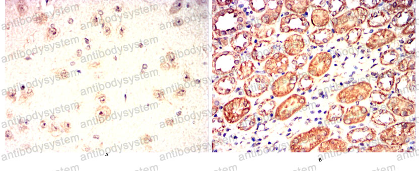 Валидация AntibodySystem RHD75202