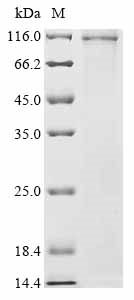 SDS-PAGE