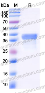 EHJ53701, SDS-PAGE